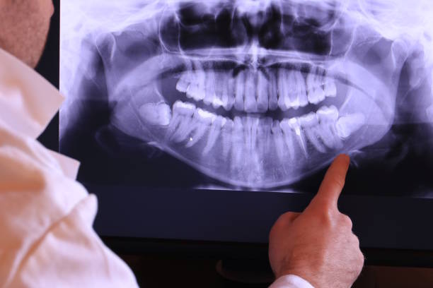 Best Emergency Broken Tooth Repair in Park Forest, IL