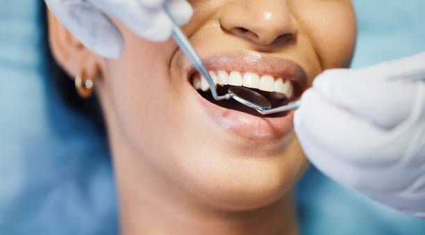 Best Emergency Treatment for Toothache in Park Forest, IL